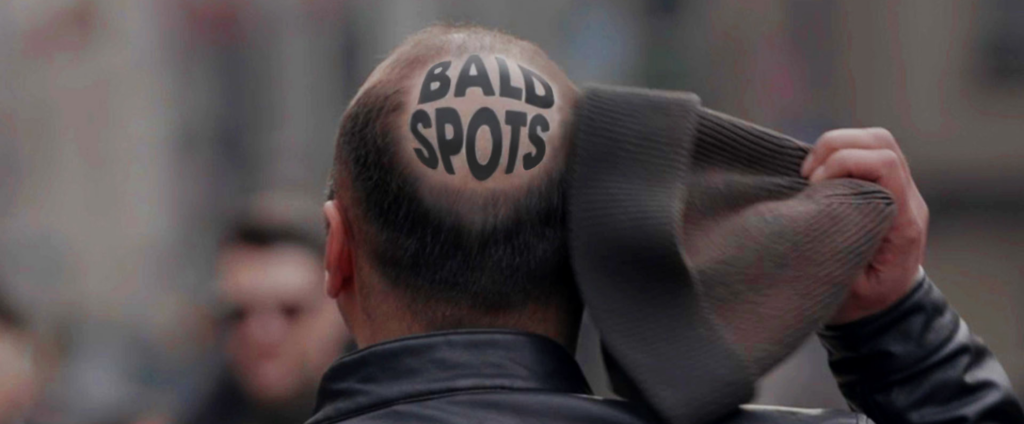 Bald Spots News Website
